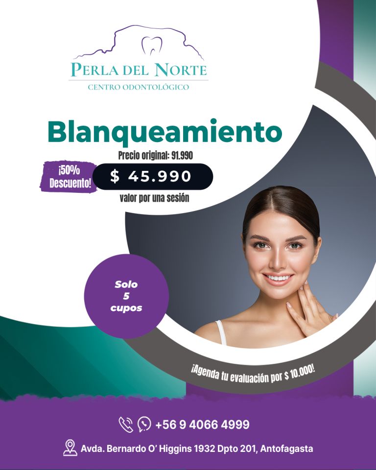 Imagen promocional de blanqueamiento dental en Centro Odontológico Perla del Norte, Antofagasta. Oferta de $45.990 por sesión con 50% de descuento, válida en septiembre. Incluye información de contacto y ubicación de la clínica.