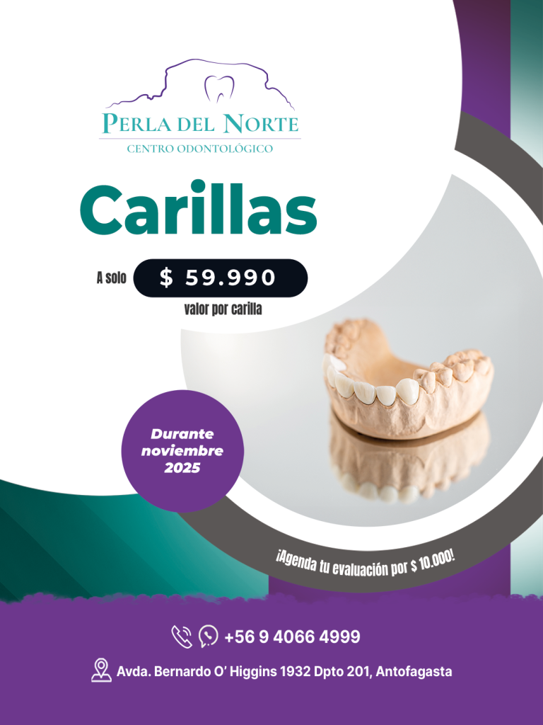 Promoción de carillas dentales de resina a $59.990 cada una durante noviembre 2025 en Centro Odontológico Perla del Norte, Antofagasta. Incluye información de contacto y ubicación de la clínica